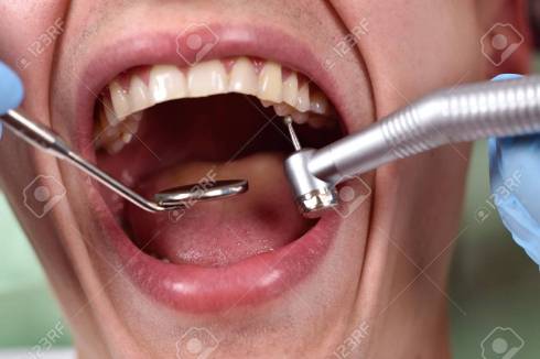 Dentist using dental drill